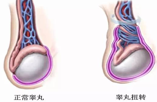 怎样补睾丸?(图1) 怎样补睾丸?