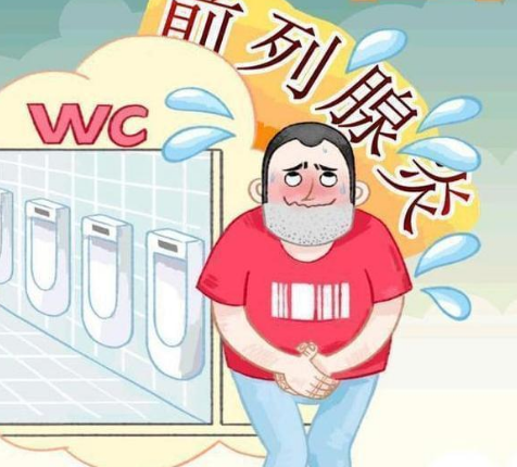 前列腺炎症什么症状?(图1) 前列腺炎症什么症状?